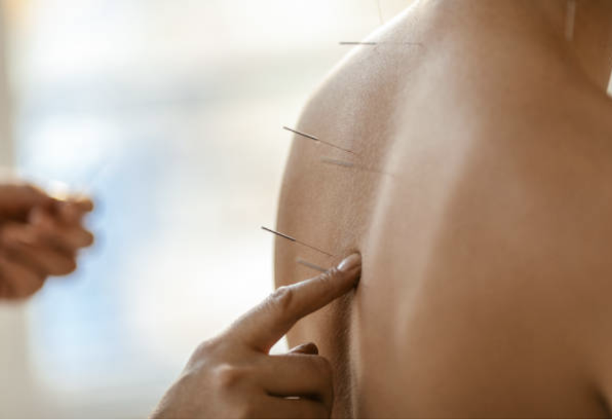 https://rienaperdre-web-ressources-dev-fcbcb104.s3.eu-west-1.amazonaws.com/therapeutes/acupuncteur/acupuncteur_2.png